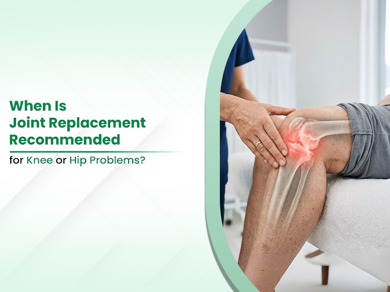 When Is Joint Replacement Recommended for Knee or Hip Problems?